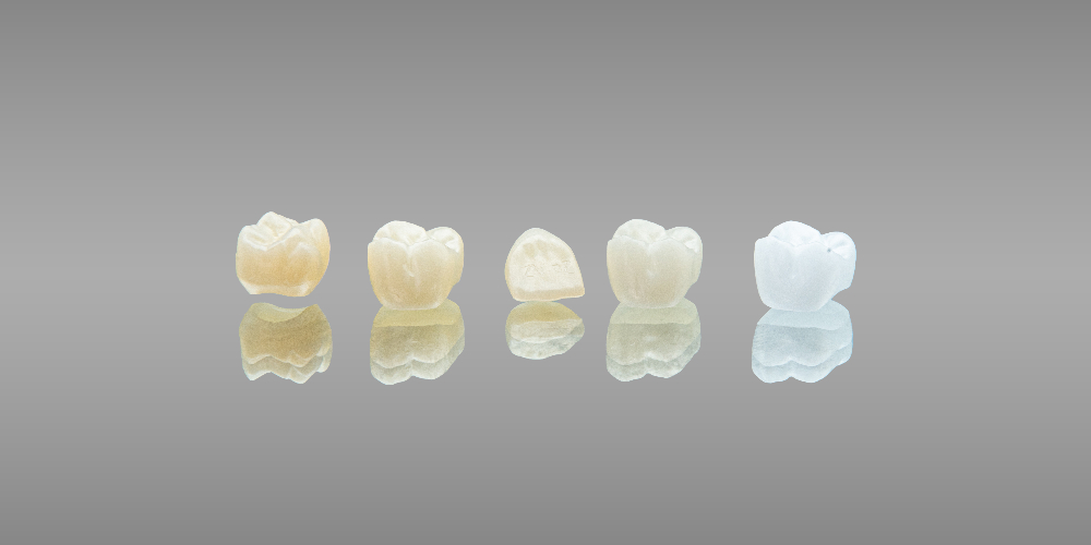 zirconia and porcelain crowns