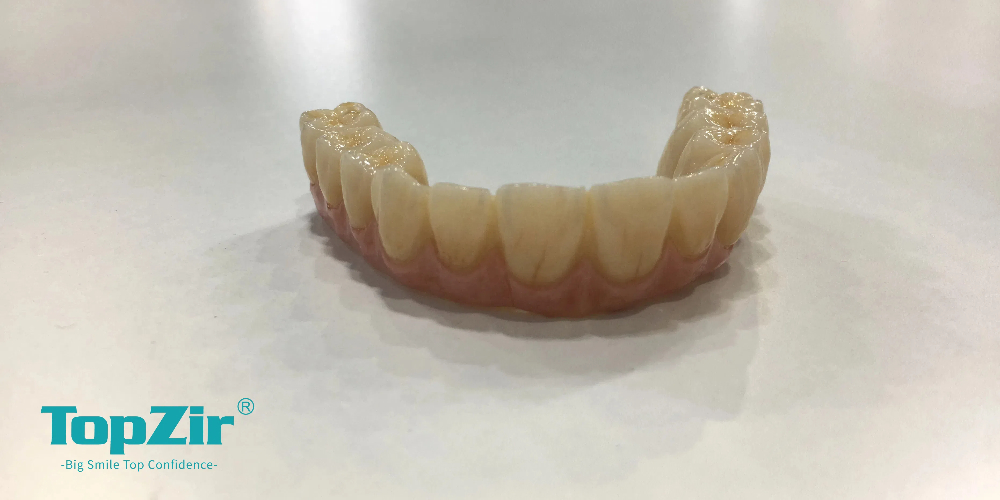 full mouth zirconia crowns