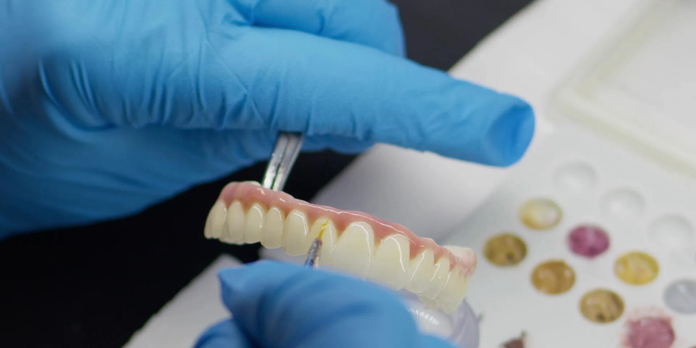 flexible dentures, dental material