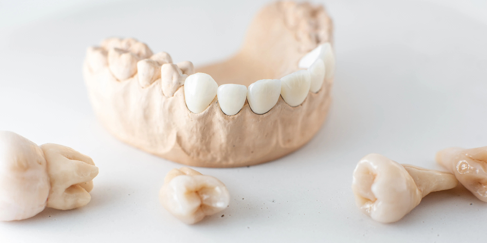 cad cam zirconia blocks