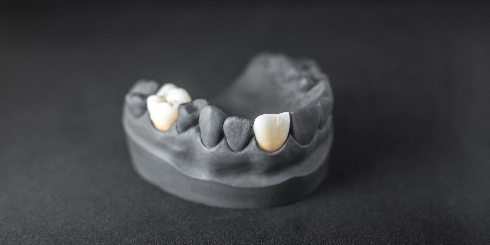 zirconia in dentistry