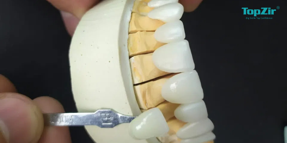 zirconium based porcelain crowns