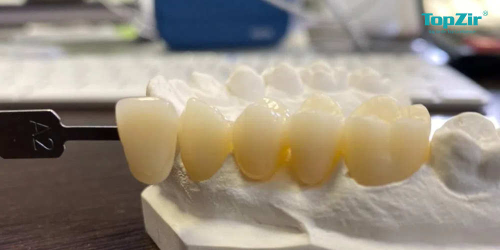 zirconia crown for front teeth