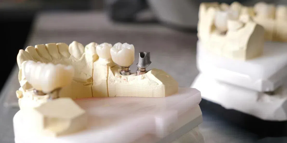 dental crowns made of zirconia