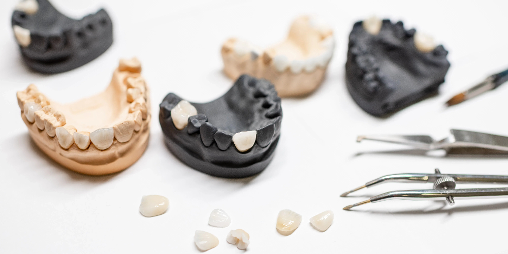 zirconia multilayer crown