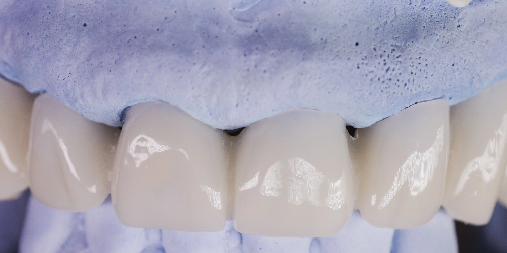 types of zirconia in dentistry