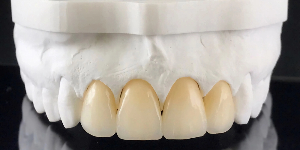 types of zirconia used in dentistry