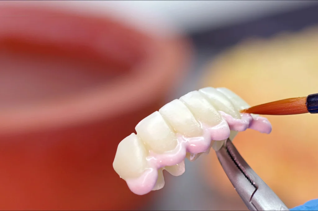 permanent zirconia teeth