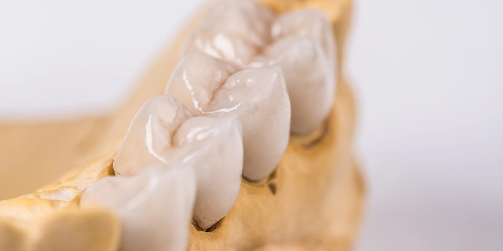 zirconia teeth