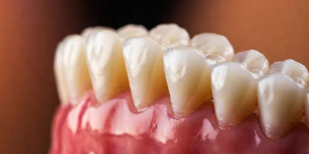 zirconia crown for anterior teeth