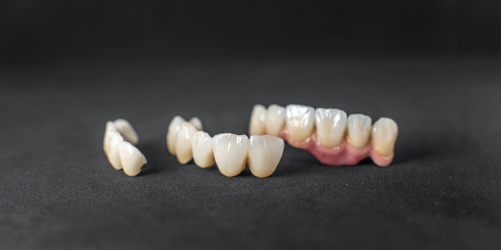 tooth crown made of zirconia