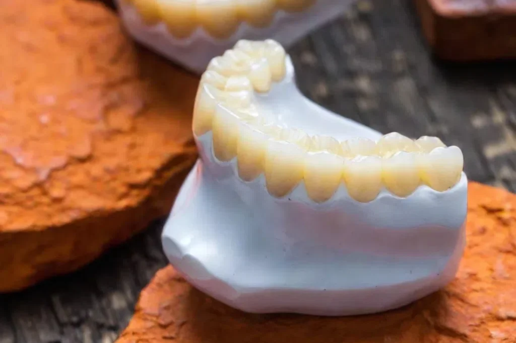 full porcelain crown vs zirconia