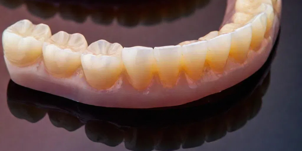 zirconia in dentistry