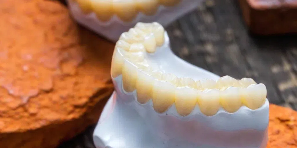 anterior zirconia crown