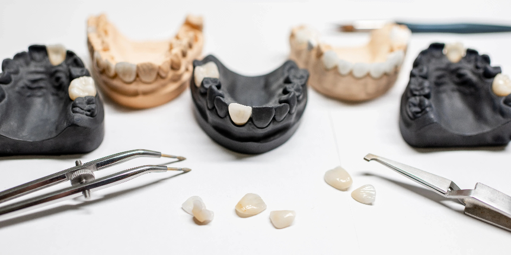 full porcelain crown vs zirconia