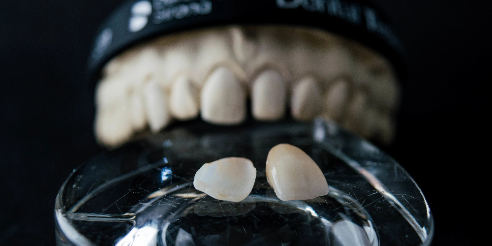 3D multilayer zirconia