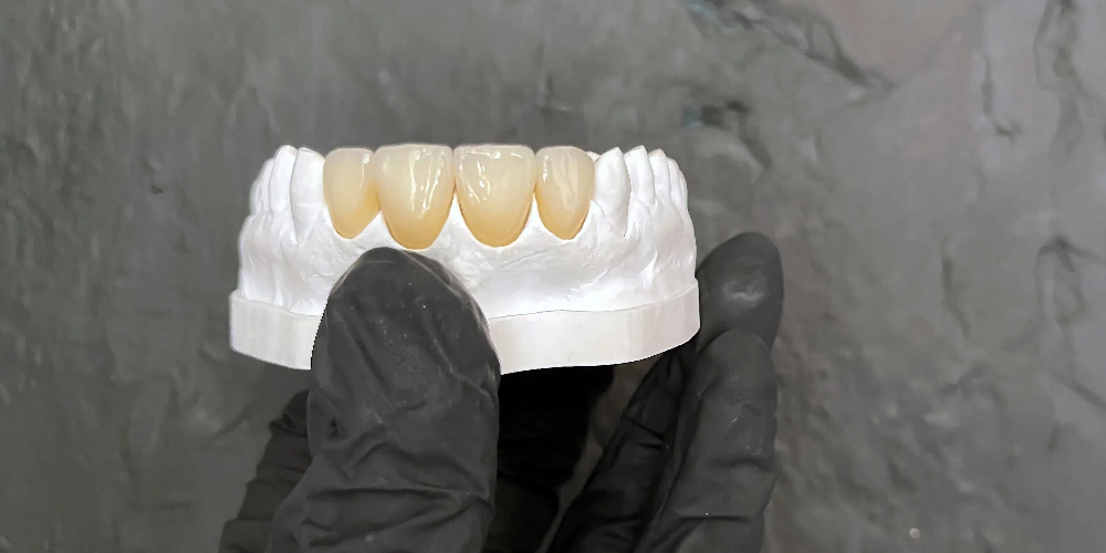 what is zirconia teeth