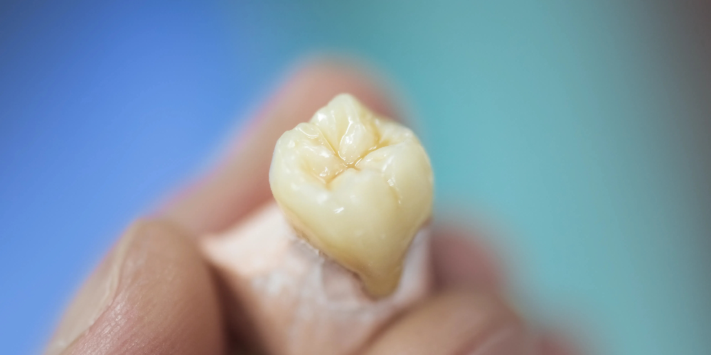 permanent zirconia teeth