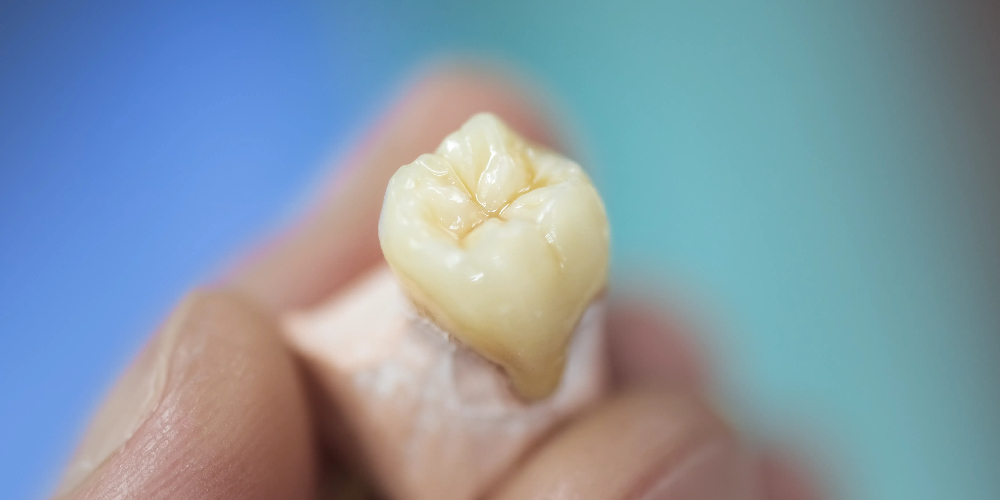 zirconium crowns