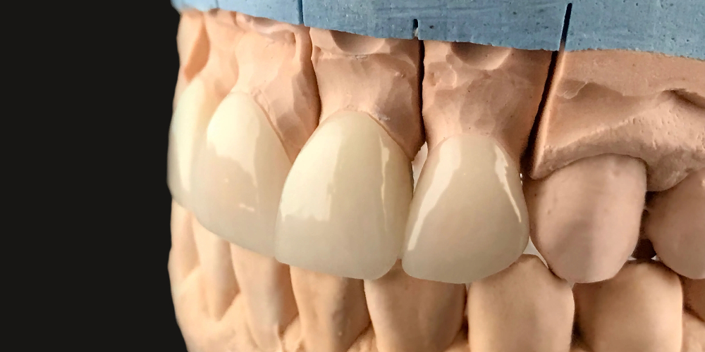 flexible denture repair