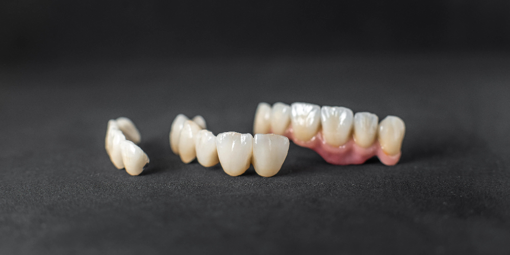 what is layered zirconia