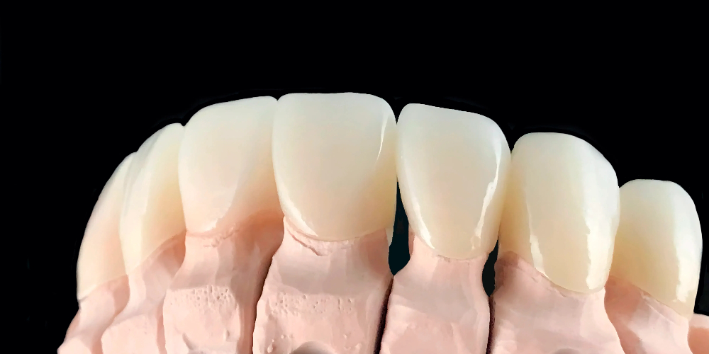 3D multilayer zirconia