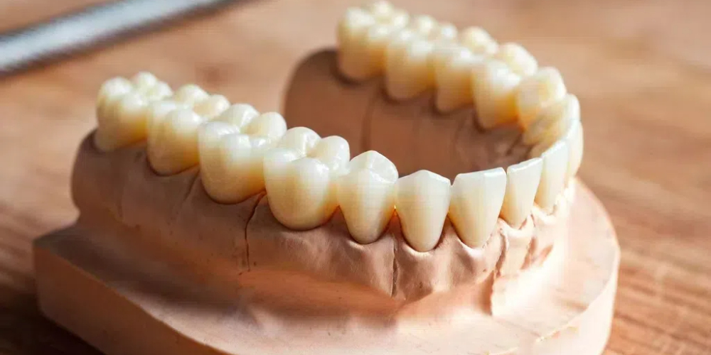 permanent zirconia teeth