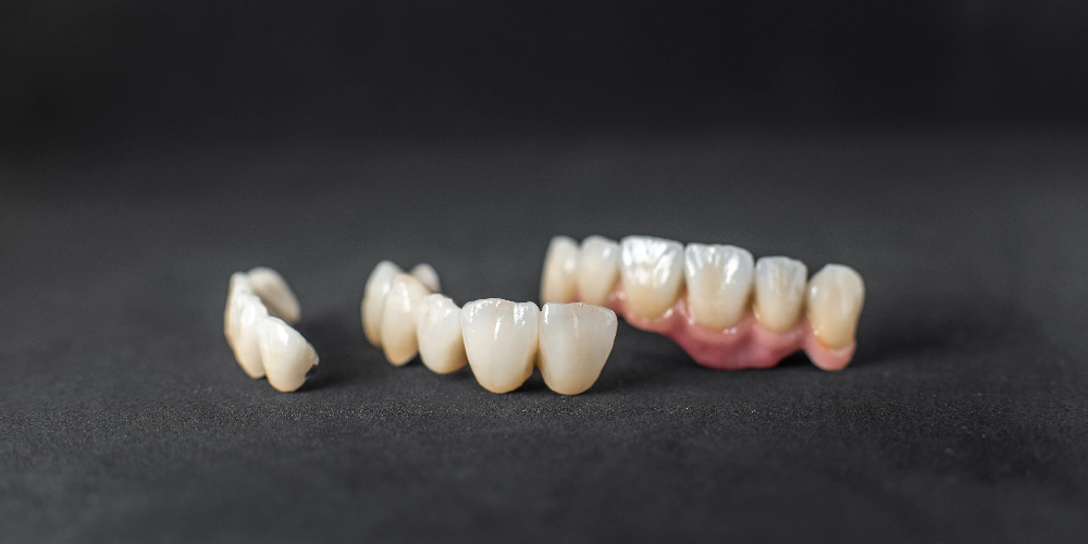 front teeth zirconia crowns