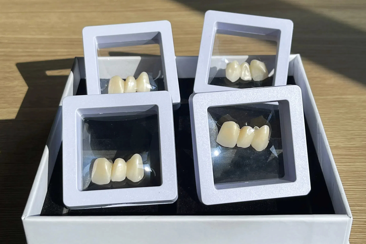 dental crowns made of zirconia